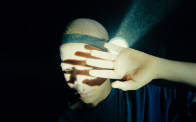 The Boy with White Skin