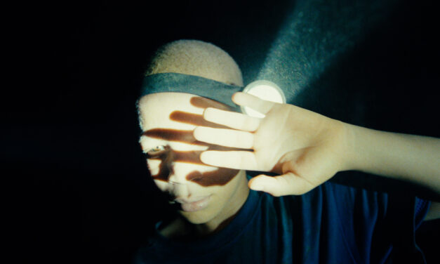 The Boy with White Skin